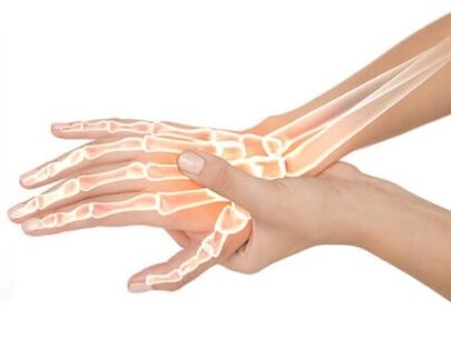 Hondrox se nanosi na zahvaćeno područje