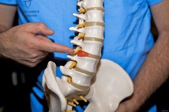 Zašto leđa boli u donjem dijelu leđa i što učiniti