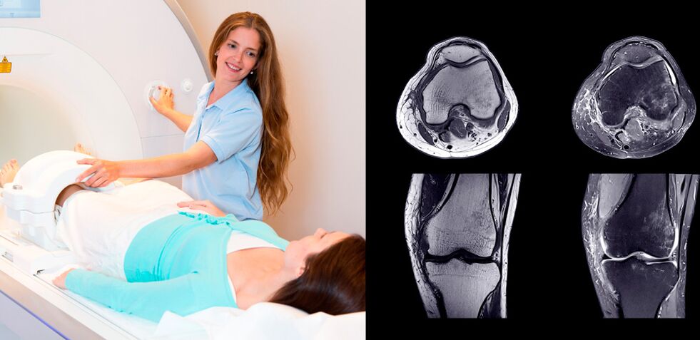 dijagnoza zgloba koljena