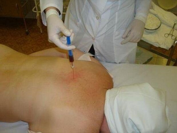 lijekovi za osteohondrozu
