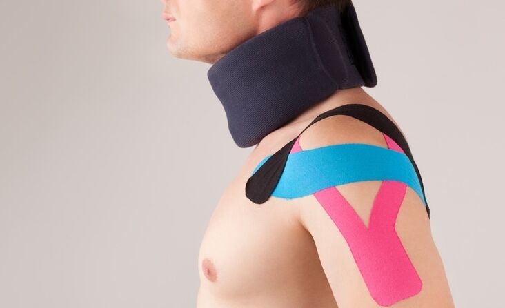Tijekom akutnog razdoblja cervikalne osteohondroze potrebno je nositi poseban ovratnik