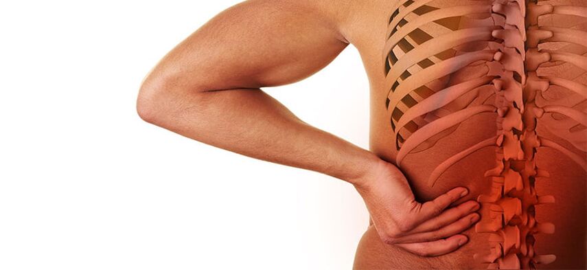 simptomi lumbalne osteohondroze